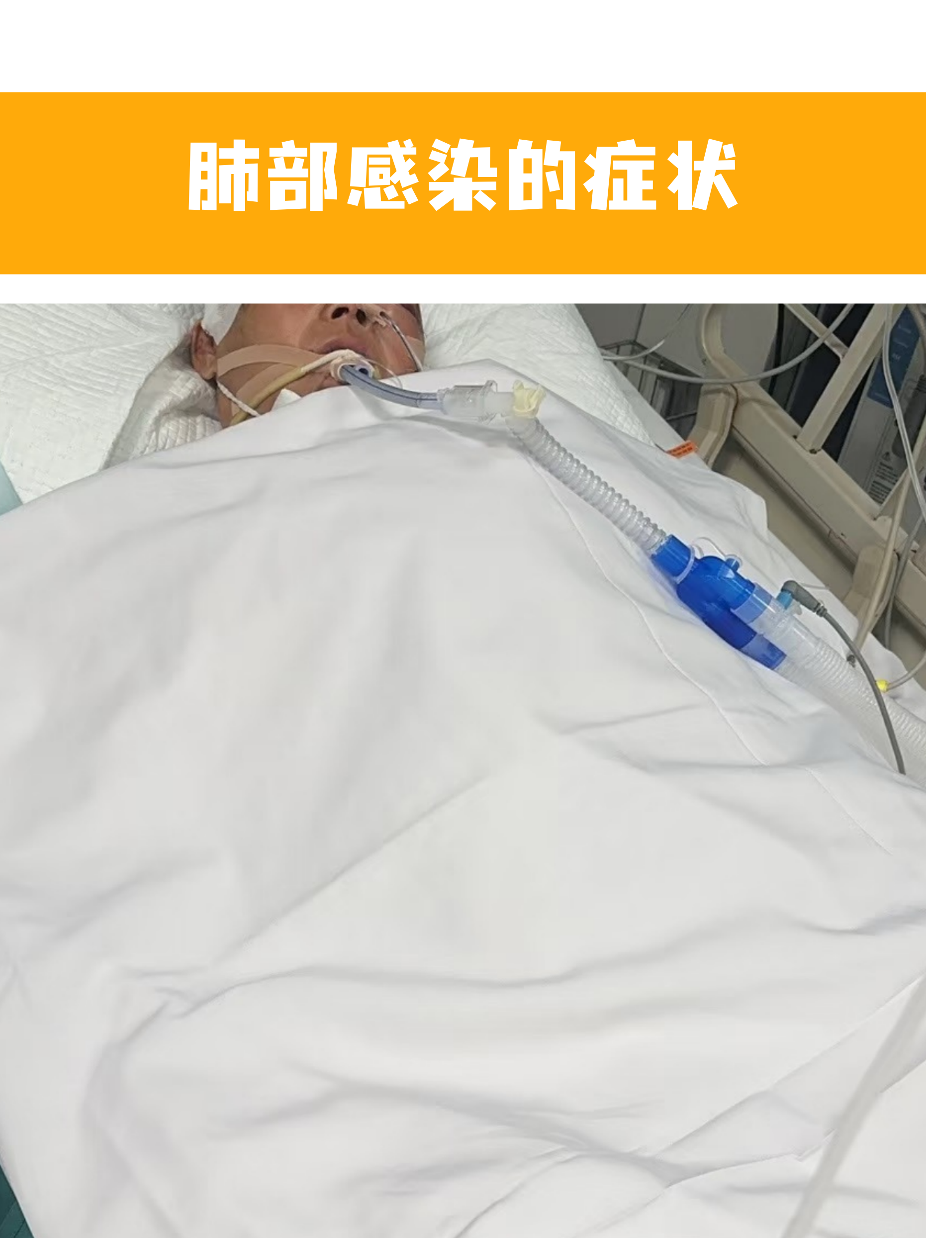 北京新增22例感染者.北京新增22例肺炎