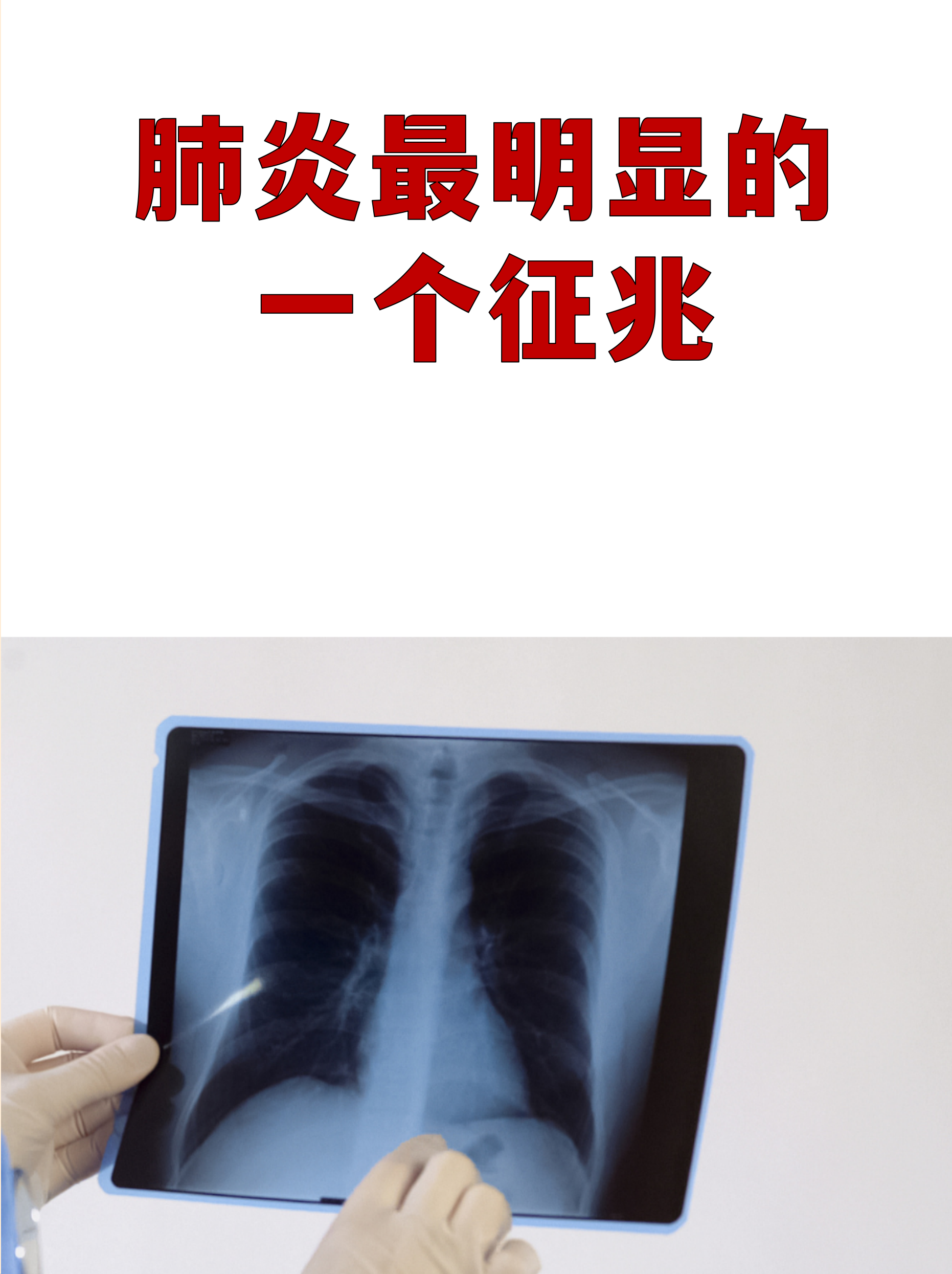 黑龙江新增23例确诊-黑龙江新增新冠肺炎23例-第2张图片