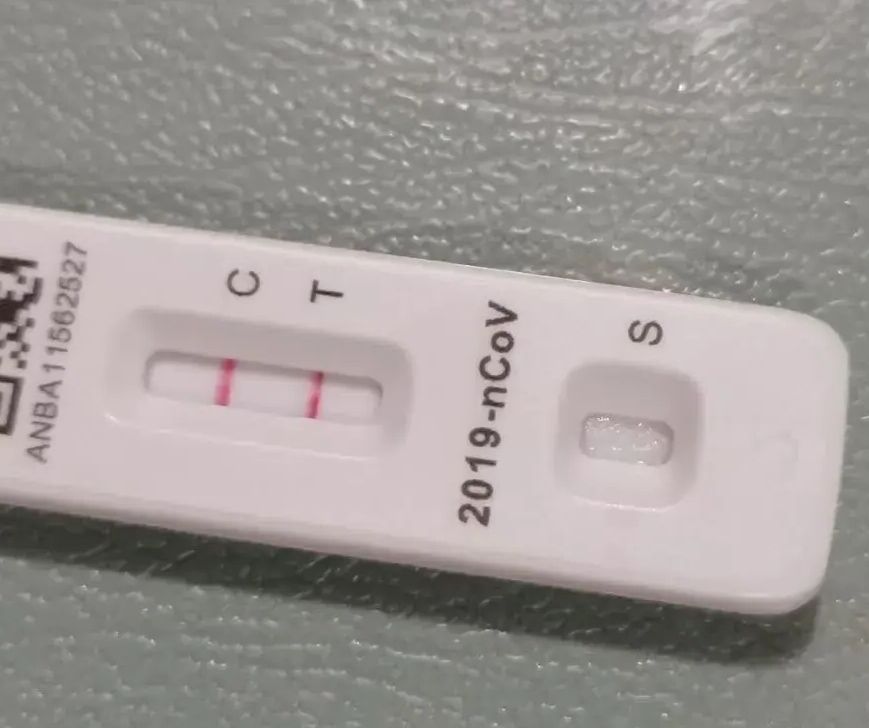 河南发现1例复阳病例.河南发现1例复阳病例是哪里的-第3张图片