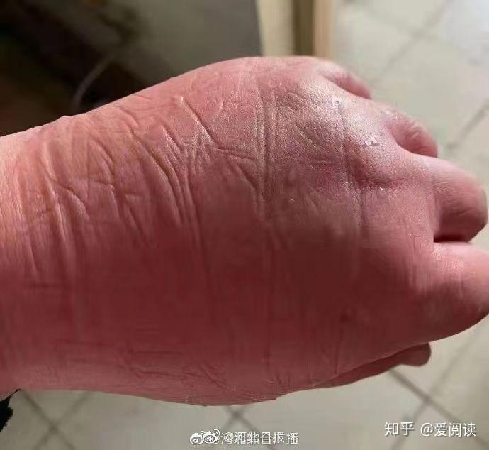 河北新增本土无症状28例,河北新增69例无症状行动轨迹-第1张图片