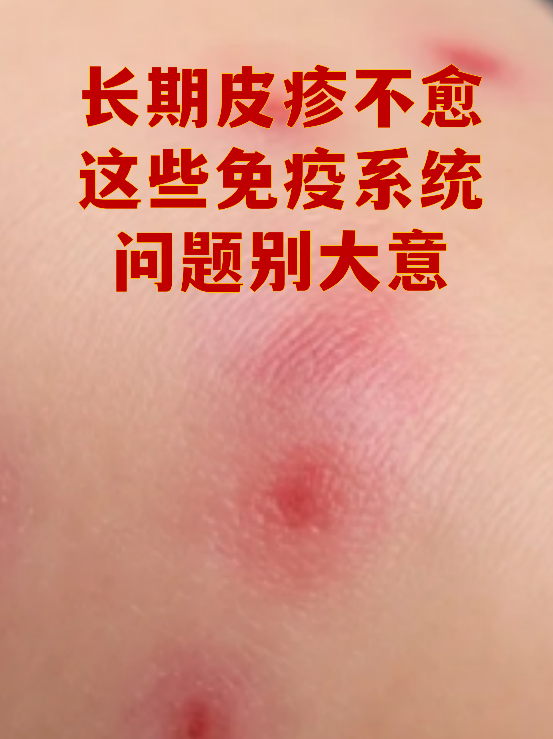 “上海社会面新增1例无症状” 上海一例无症状？-第1张图片