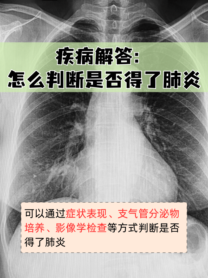 「肺炎北京10例了」〃北京肺炎2020-第2张图片