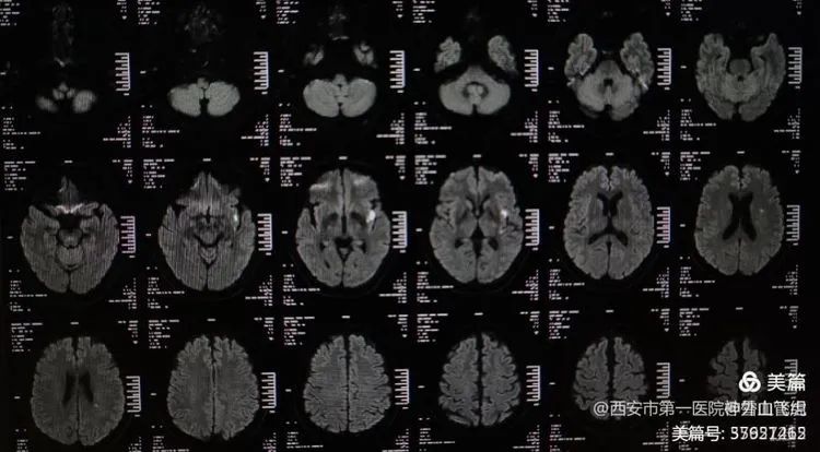 “西安:未来几天新增病例仍可能较多” 西安今明后三天最新消息？