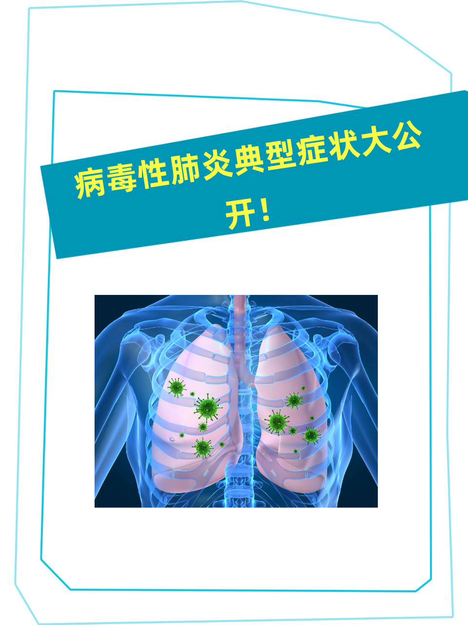 全国肺炎最新消息图〃全国肺炎最新消息图表