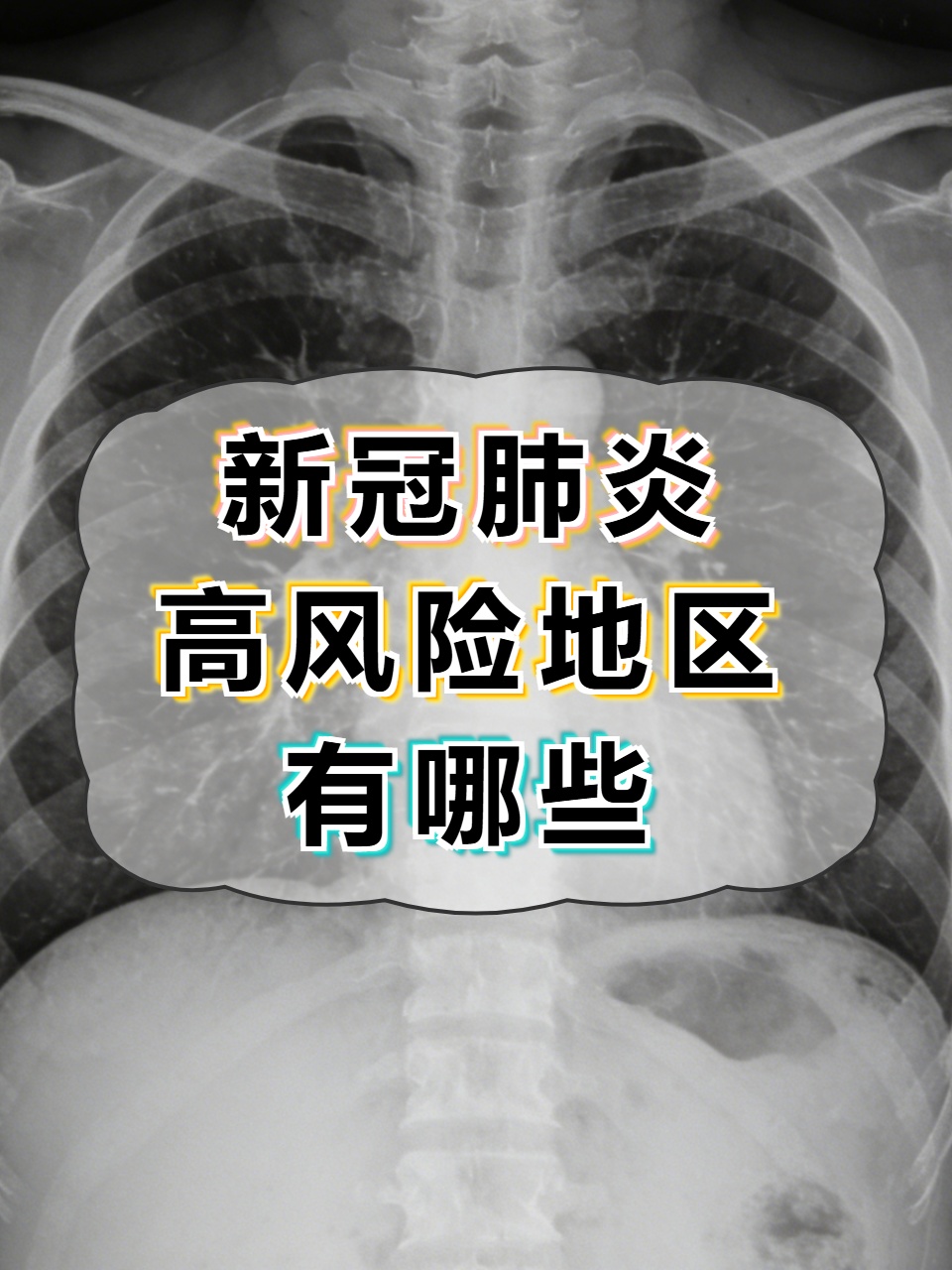 全国疫情高风险地区清零︰(全国疫情分布图)-第2张图片