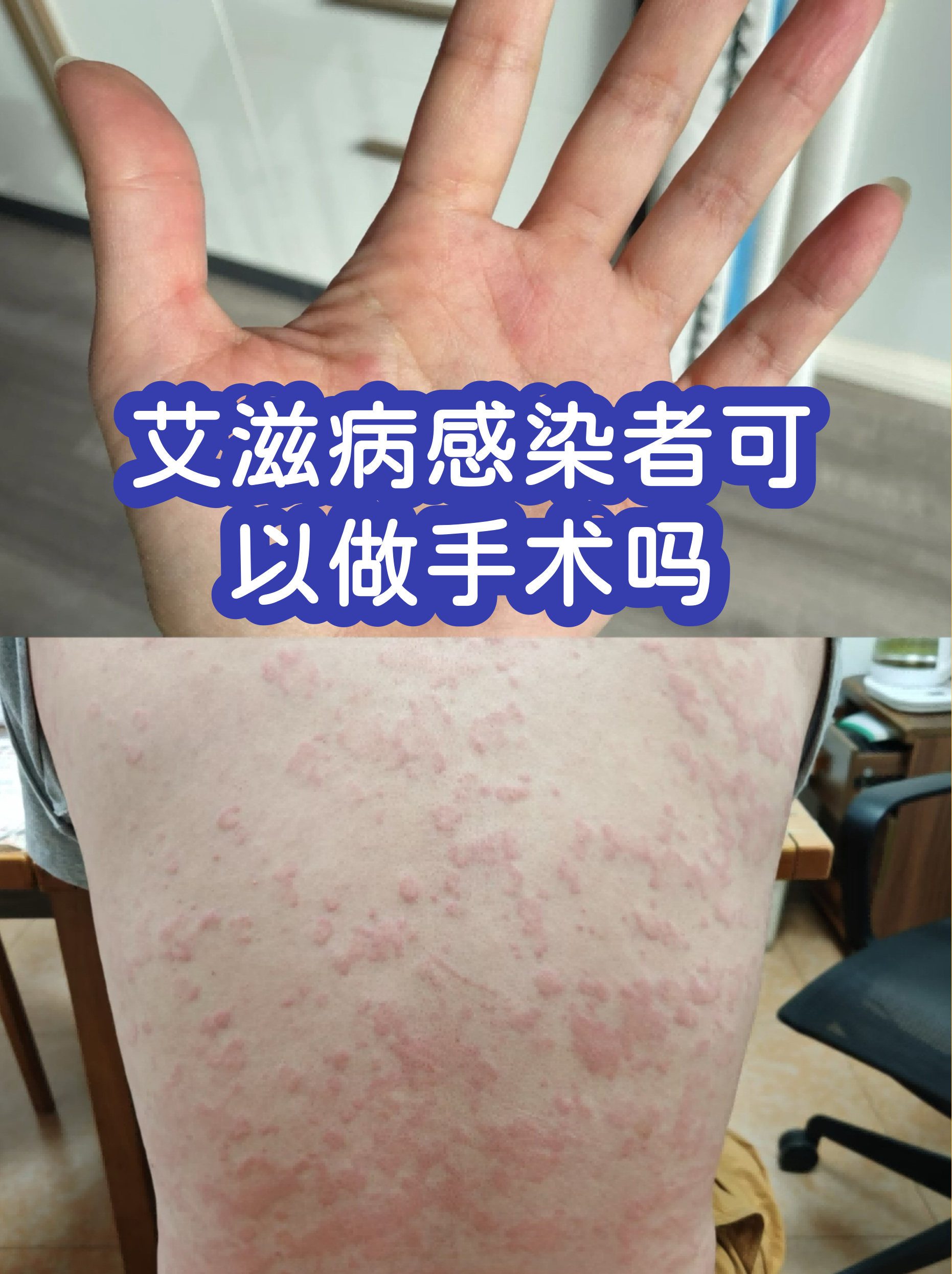 上海感染者增超2万,上海hiv感染者