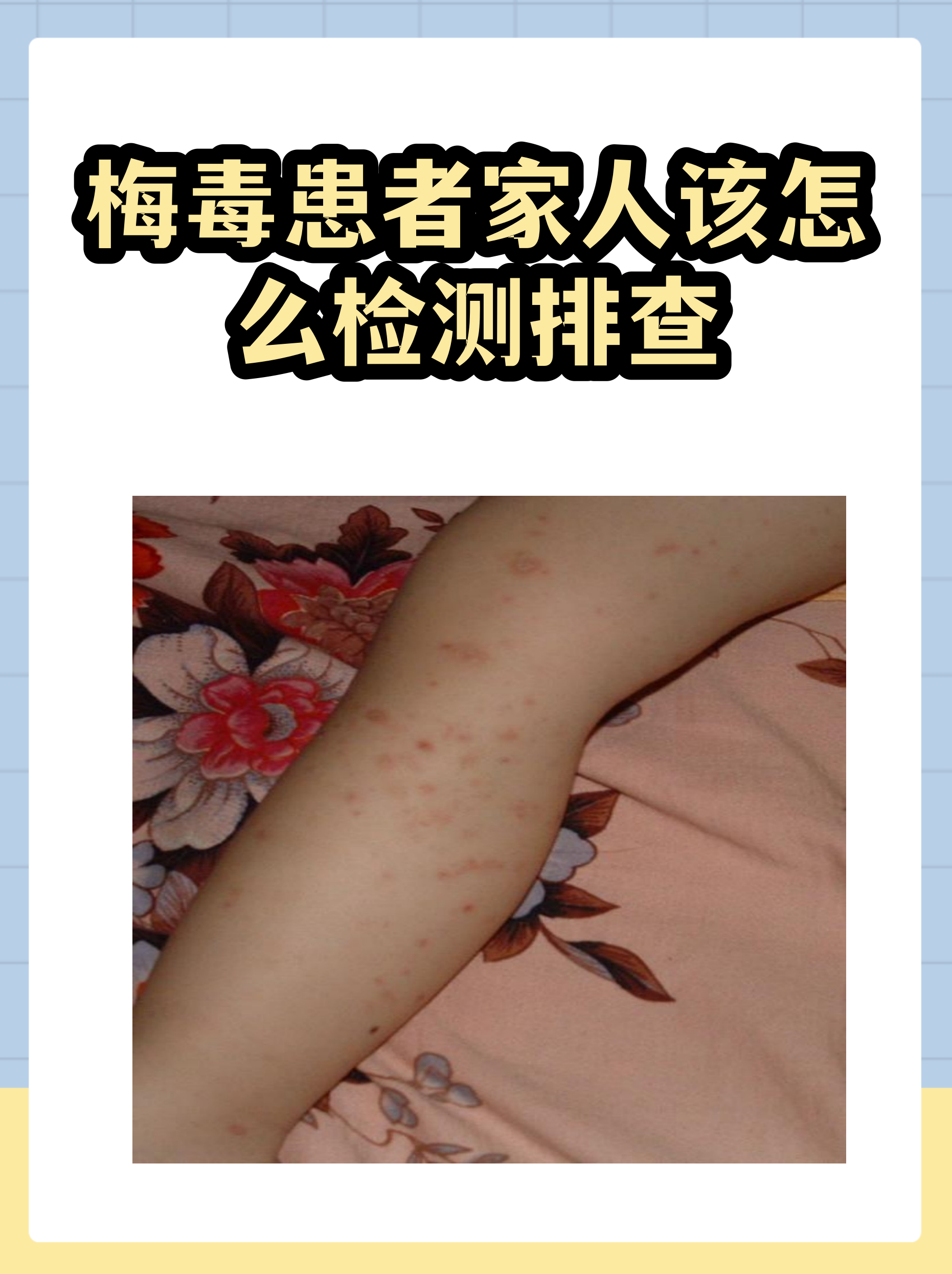 最新确诊病例︰(最新确诊病例最新消息)