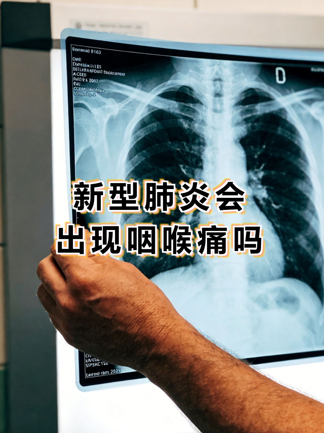 郑州新型肺炎,2020新型肺炎症状