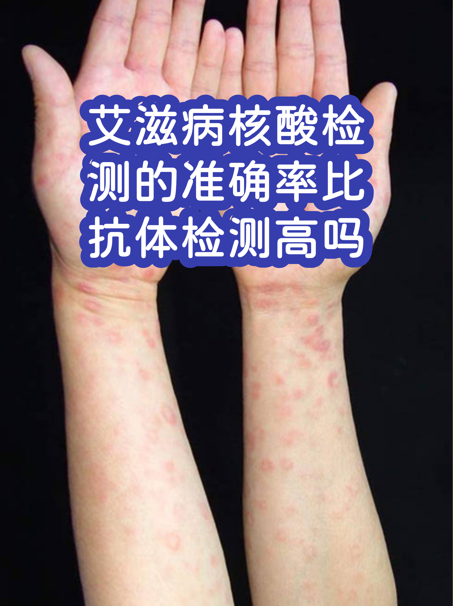 北京核酸检测最新要求.北京hiv核酸检测费用