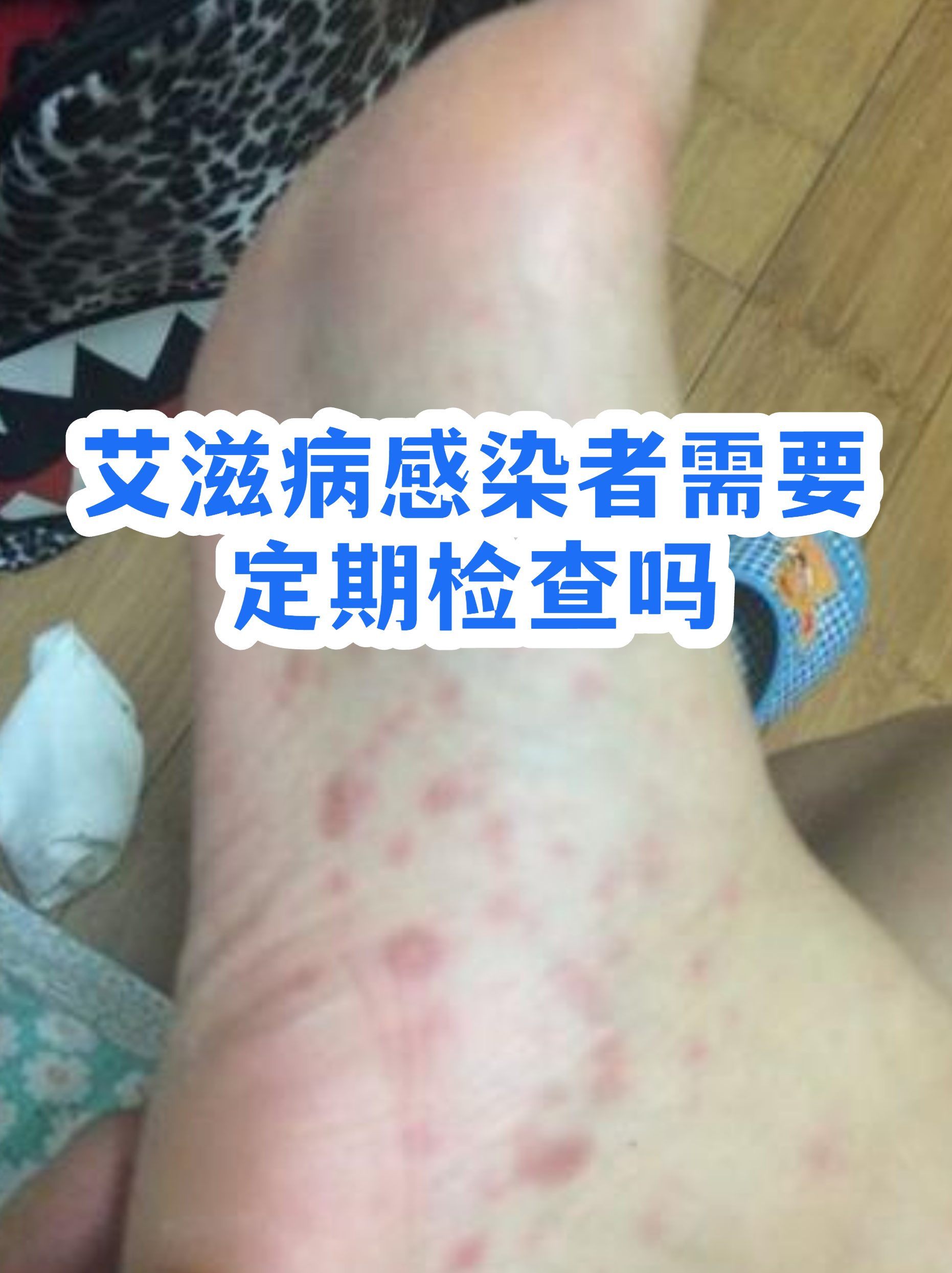 上海感染者增超2万︰(上海hiv感染者)